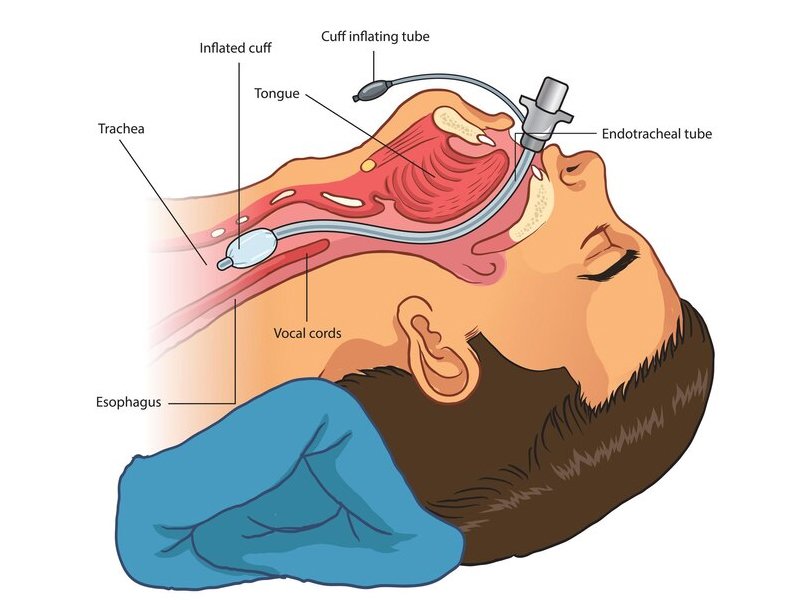 Head & Neck Cancer Surgery Ahmedabad