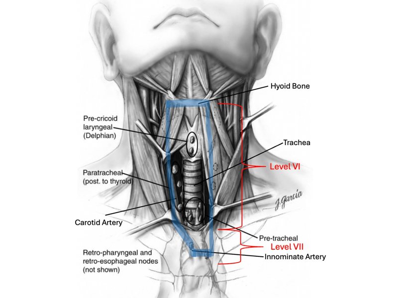 Neck Dissection Surgery in Ahmedabad